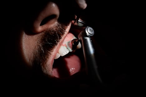 igiene-dentale-5